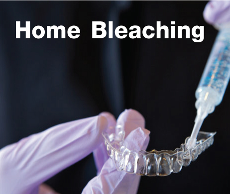 Home Bleaching For Yourself!!